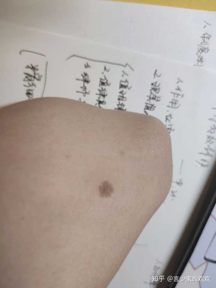 你见过什么特殊的胎记?