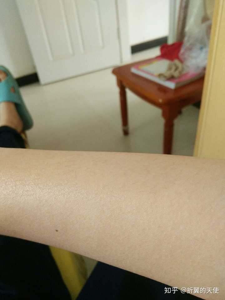 我现在十六岁处于青春期,几乎哪都长毛,不知是雄性激素过多导致的还是