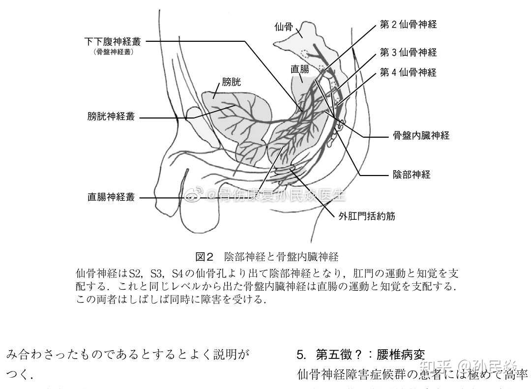 会阴痛を主诉とする仙骨神経障害の病态の解明に向けて