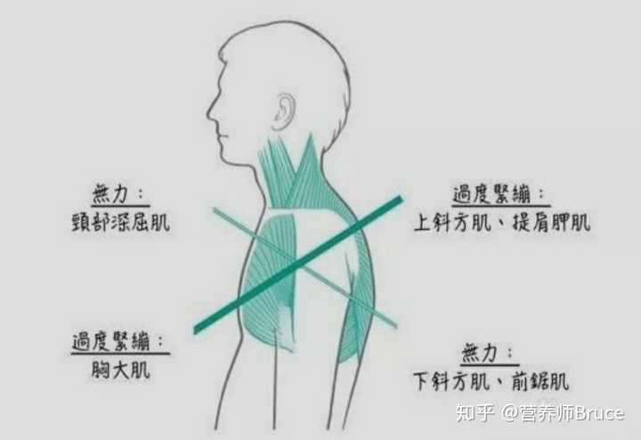 靠墙站真的可以矫正驼背伸脖子吗?