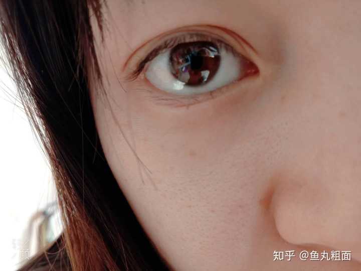 俺另外一只双眼皮不长这样 眼头的眼皮是合在一起的 就不放了 这只