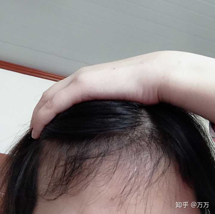 然后前额看起来好像明显一点,长出的碎发