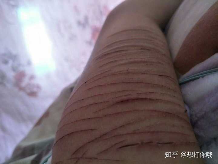 患有抑郁症是种什么感受