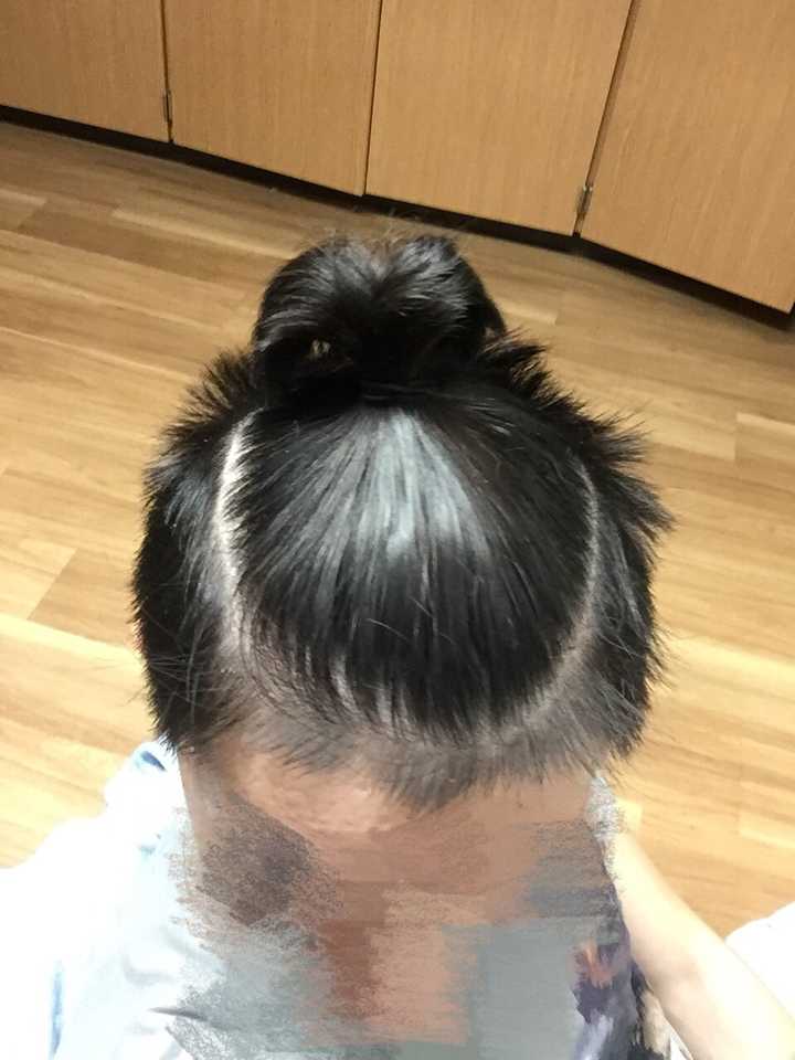 男生怎么样才能留长头发?