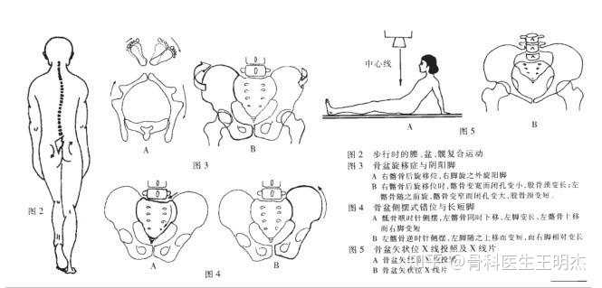 如何调整骨盆?