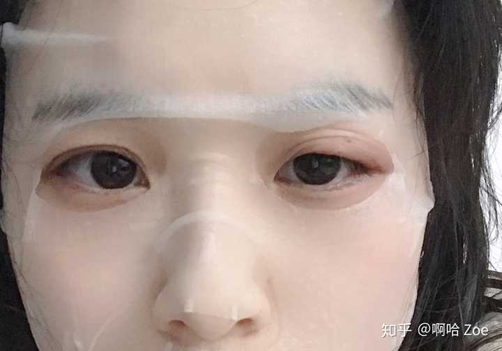 突然上眼皮就肿起来了,而且又痛又痒,眨眼都痛,现在眼睛已经肿的特别