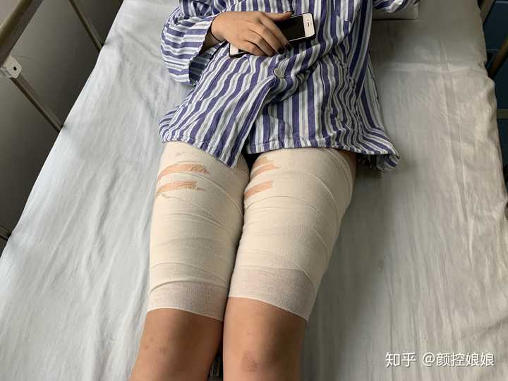 吸脂有哪些危害和后遗症?
