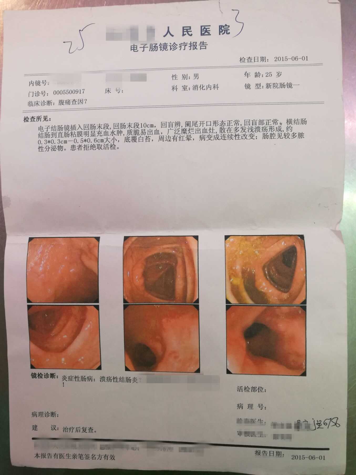 作为一个溃疡性结肠炎患者,我也来答富个吧.