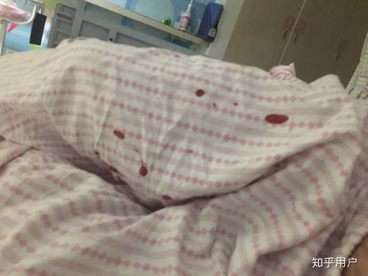 生宝宝的时候是提前住院放水囊,我让老公送婆婆回家了,下着大雨本来