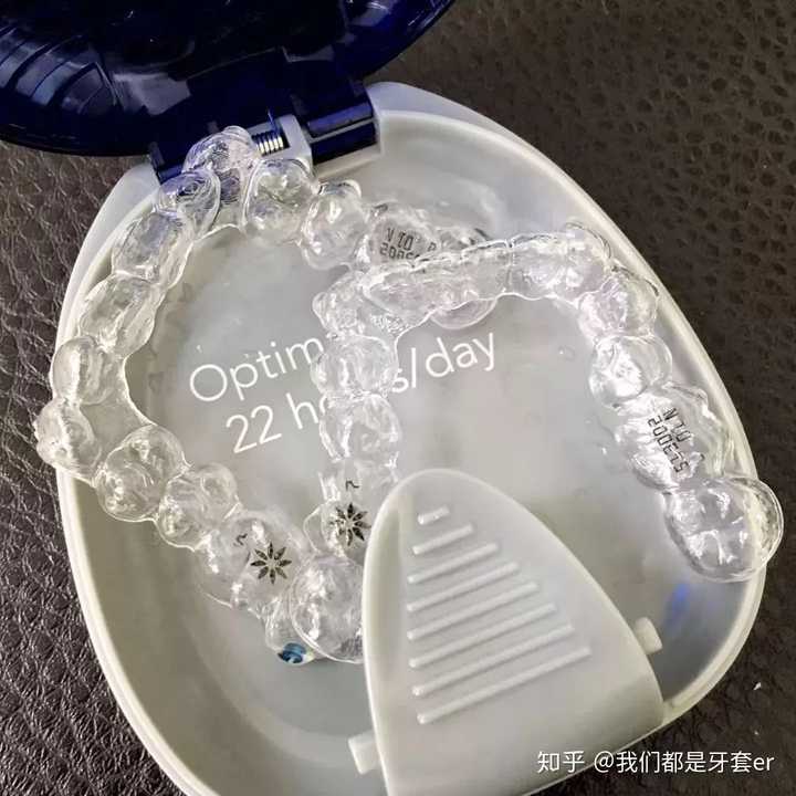 女孩子带牙套是不是很难看?