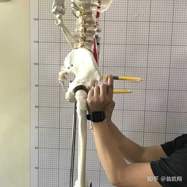 怎么矫正骨盆后倾?
