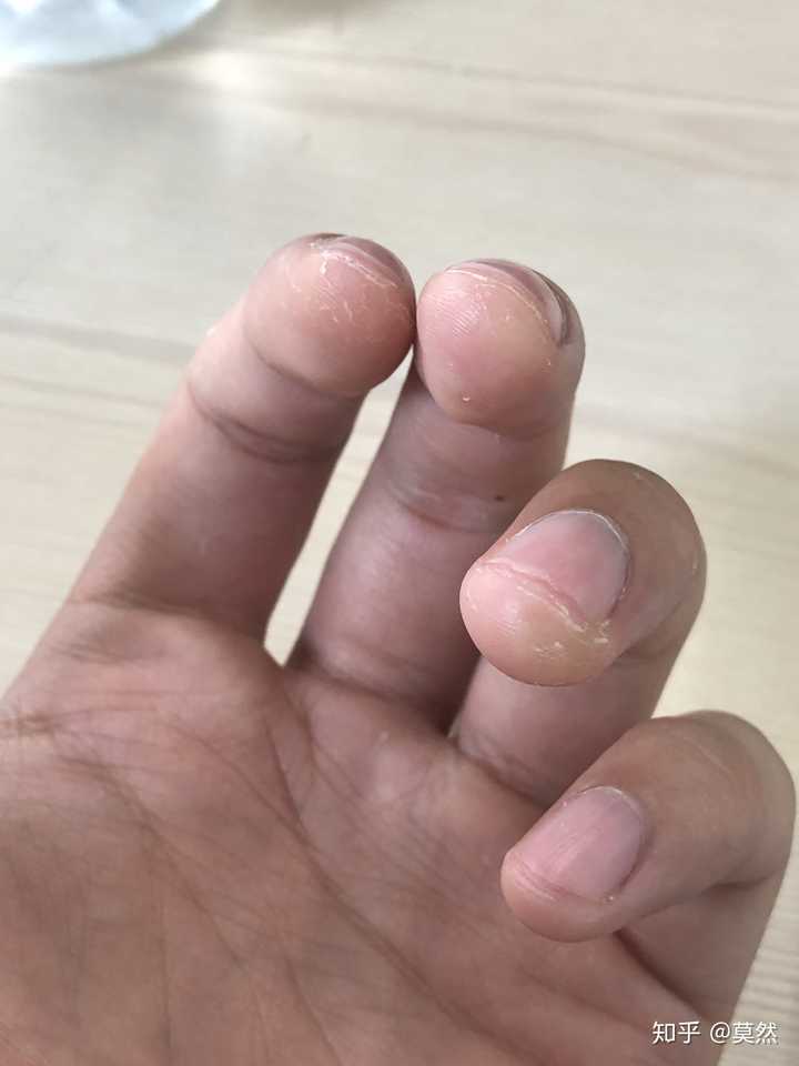 弹吉他的同学指尖都是很软很嫩的,不过有时候会手痒把起皮的茧子给