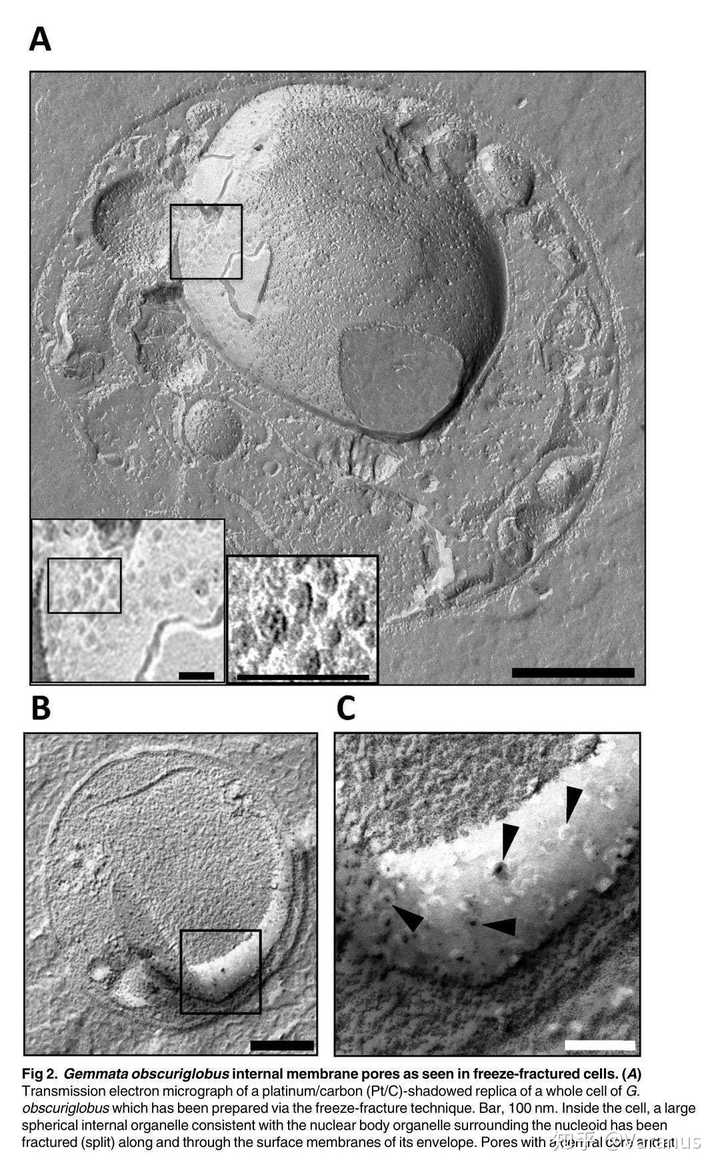通过冷冻蚀刻,负染色等技术,我们得知出芽菌的"核孔复合物"和真核生物