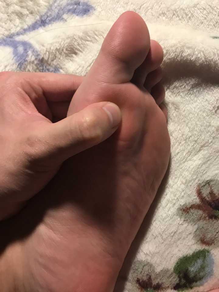 左脚掌这个部位莫名的疼 已经影响到走路?