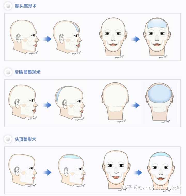 大扁头怎样变圆头啊?