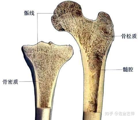 同意松质骨