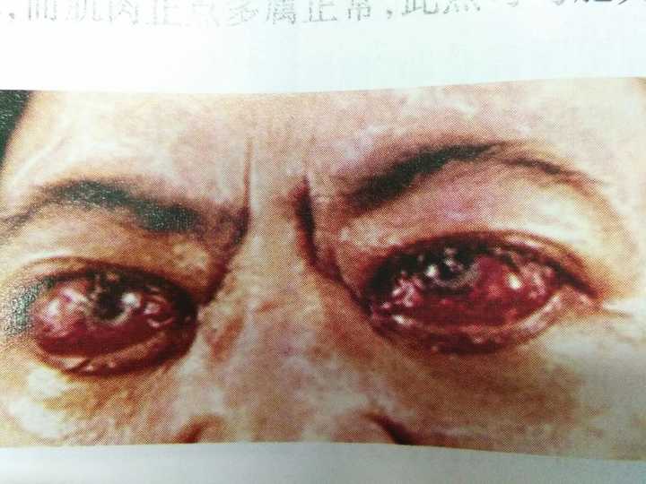 你见过哪些看着就疼的操作?