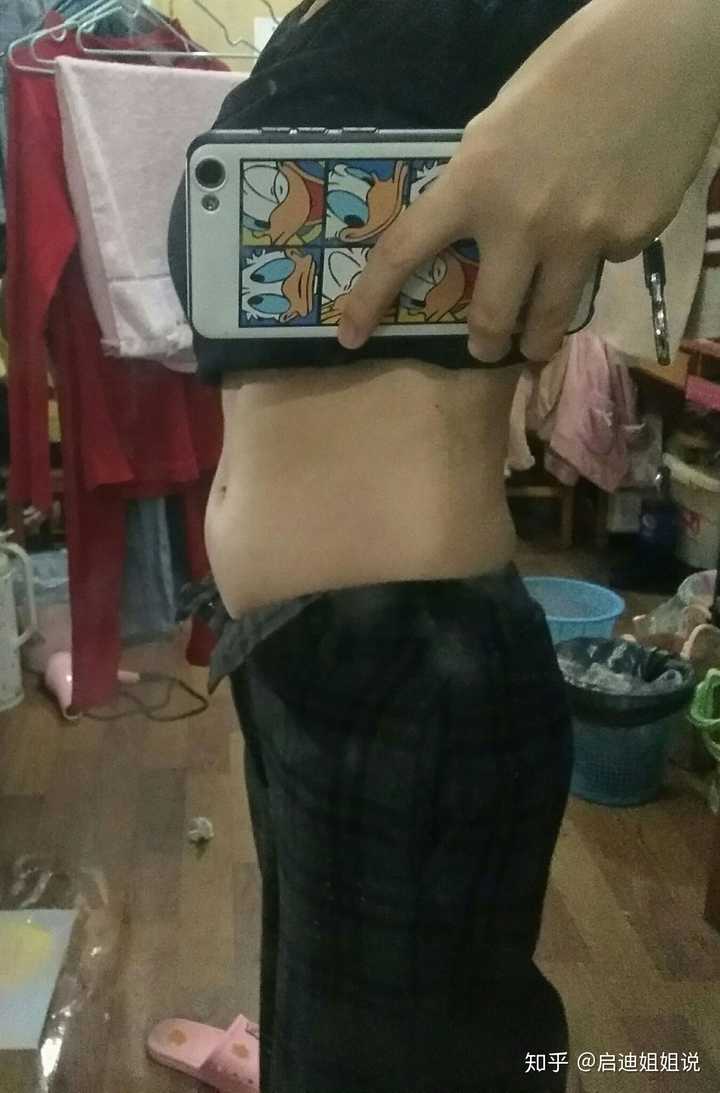 脂肪堆积最多的地方有肚子,大腿,颈部,背部.