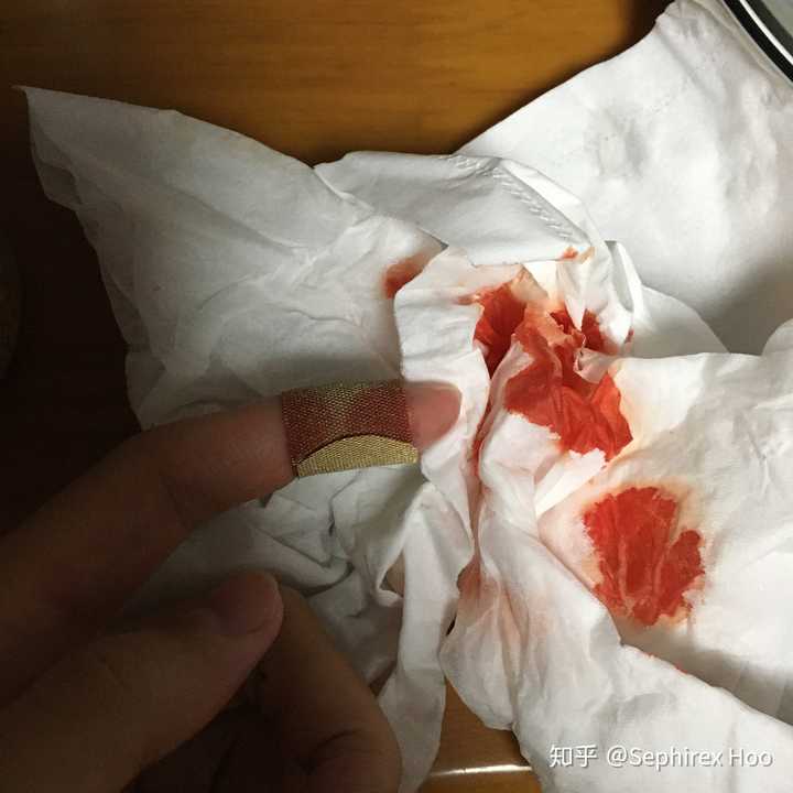 菜刀割伤了手,但是爸爸冲过来帮我压住伤口,沾的满手是血还匆忙帮我找