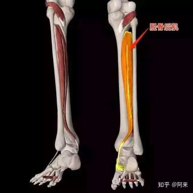腓骨长短肌松解 强化胫骨后肌,每组20-30次,做3-5组.