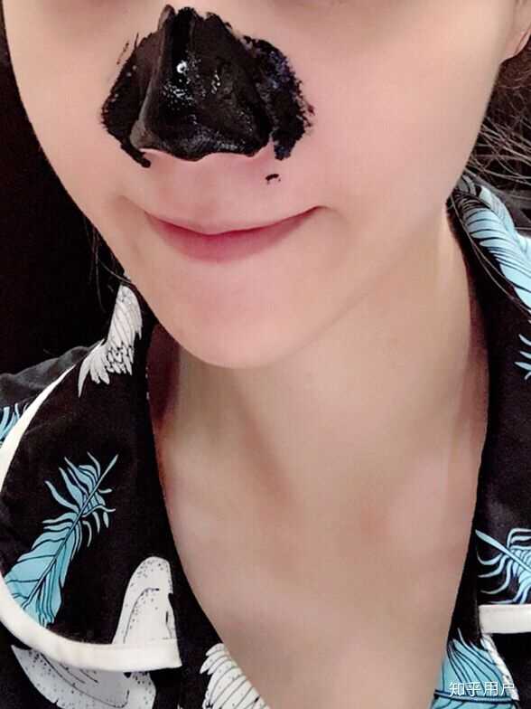 有什么有效去黑头的办法呢?