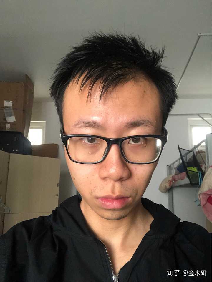 发际线高且m型发际线的男人适合什么发型?额头较大?