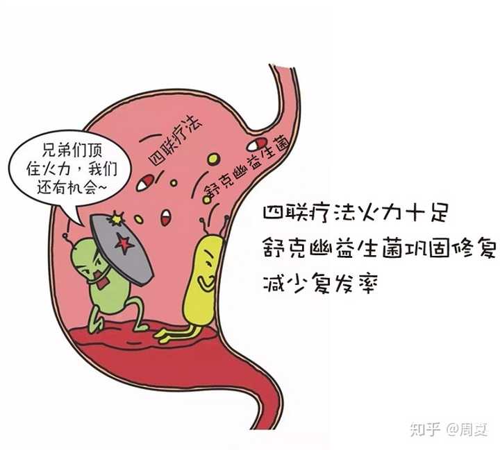 幽门螺杆菌超标是否可能通过不吃抗生素治愈?