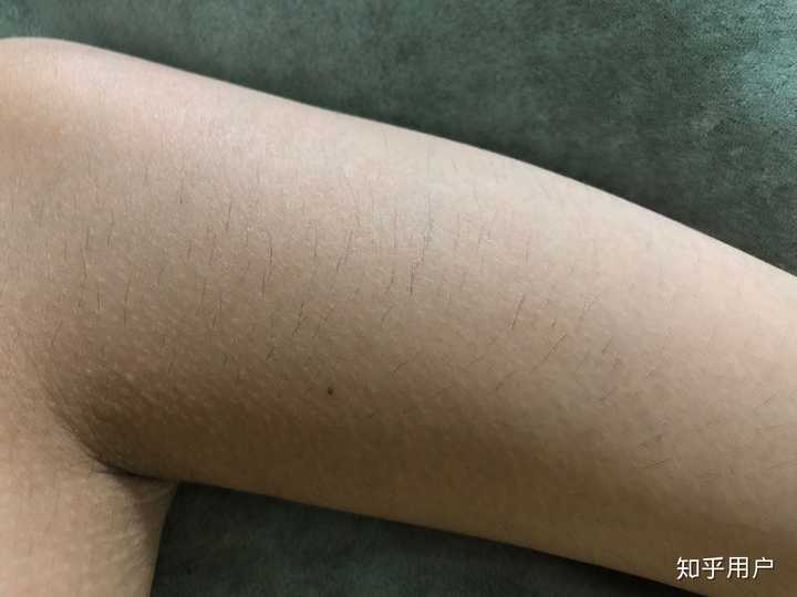 那啥 手毛过了两个月 长成这样了