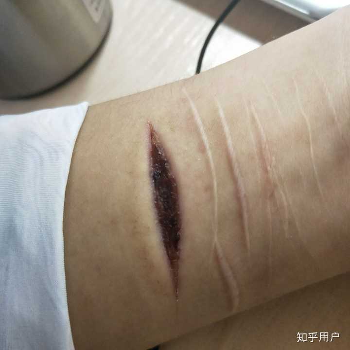 患有抑郁症是种什么感受?