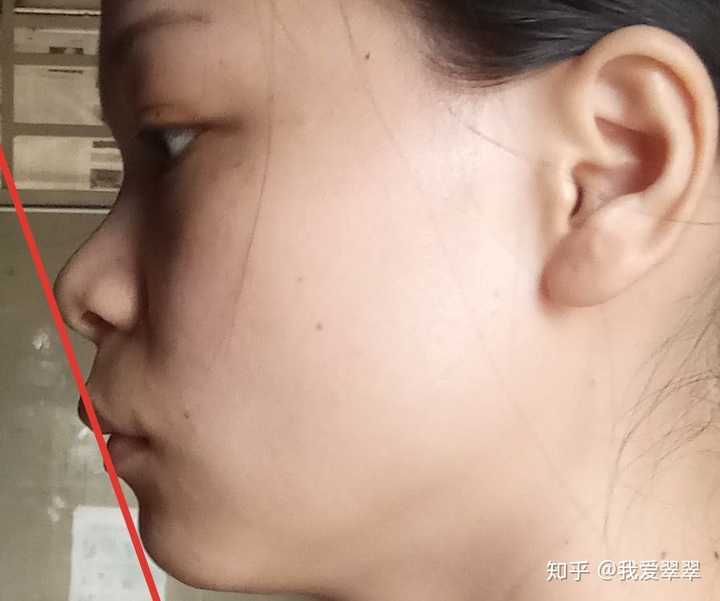 如何,有点担心……但是我的嘴巴凸……侧脸完全没法看(看下面的图)