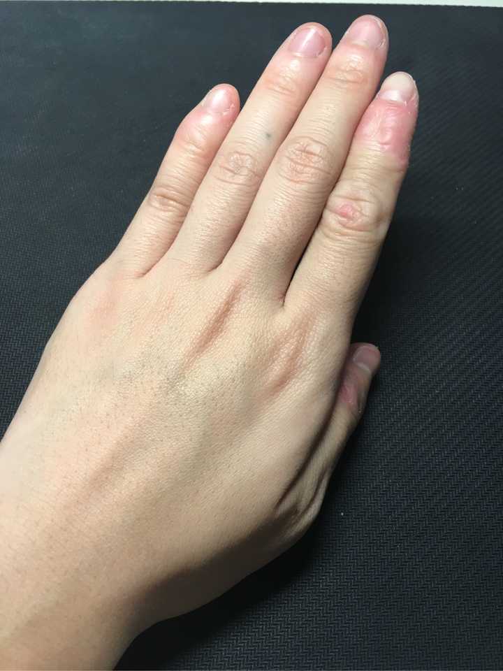 如何戒掉咬手指的习惯?