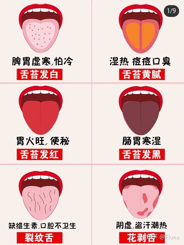从舌头看身体状况
