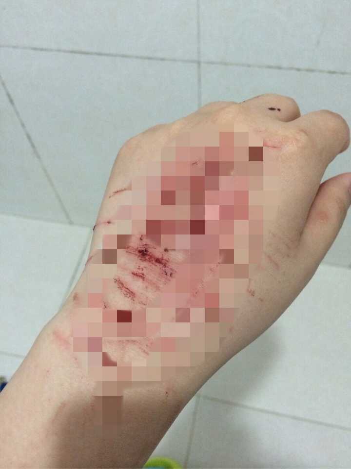 你被抑郁症折磨成什么样子了?