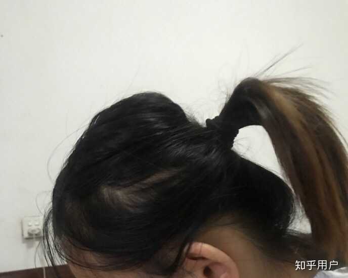 男女生后脑勺头扁是种什么体验?