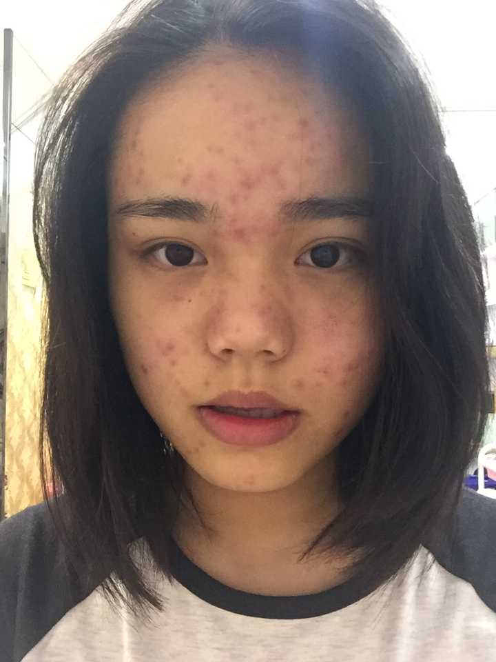 皮肤由差变好是什么体验?