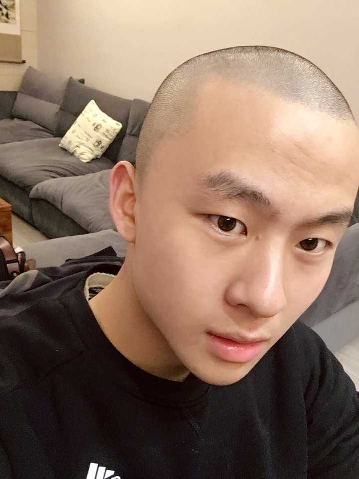剃光头对自身有什么坏处?