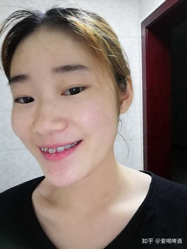 有没有因为牙齿不好看而毁了整张脸的例子?