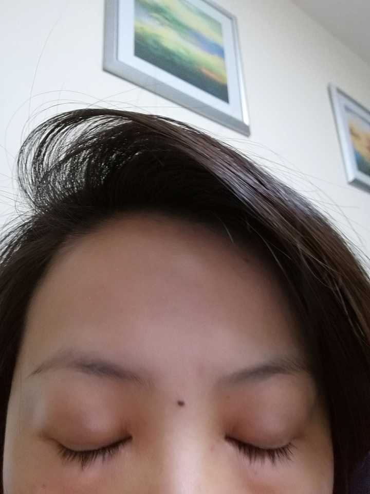 从小到大已经习惯和看惯的美人痣～额 长在印堂眉心处