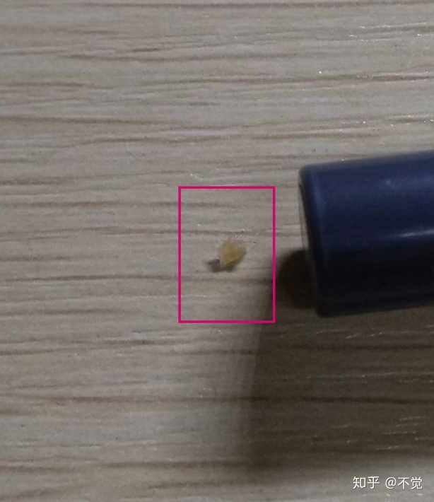 史上最大的黑头有多大?
