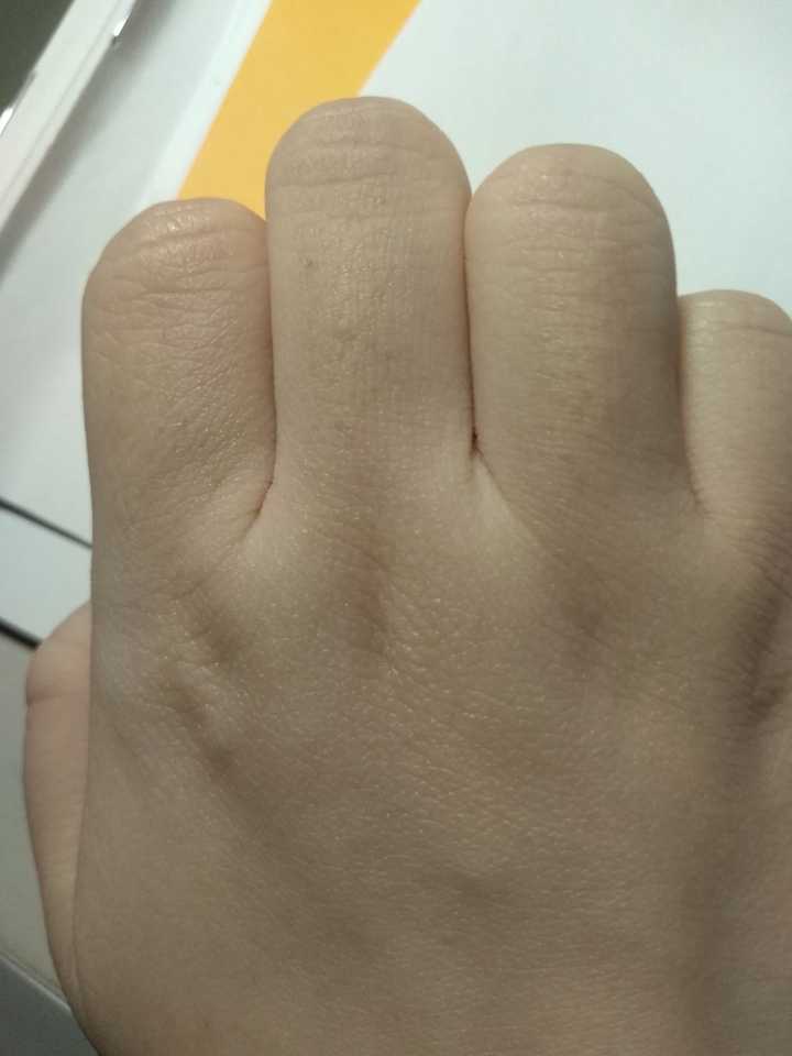 蒂丝脱毛仪对于特别黑硬的胡子和汗毛效果怎么样!