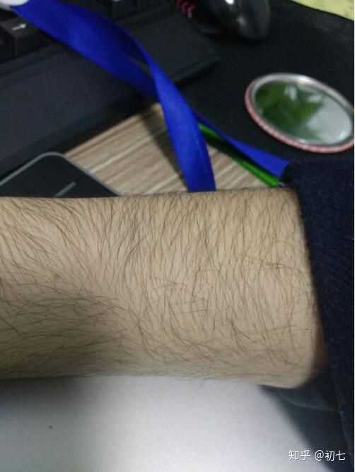 正常女生汗毛过长有什么解决办法吗?