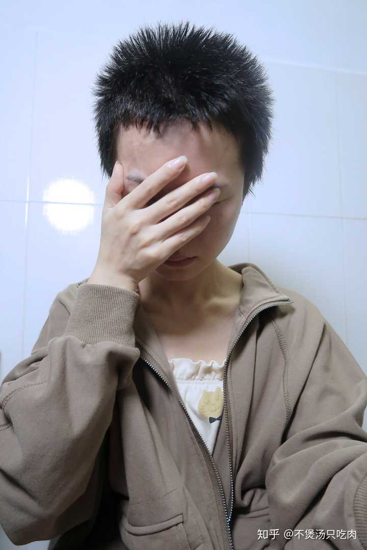 去拍了放大版的发囊,发现发囊里很多头发细的可怜,想问下怎样剃光头能