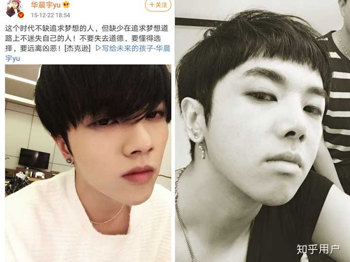 华晨宇为什么整容?