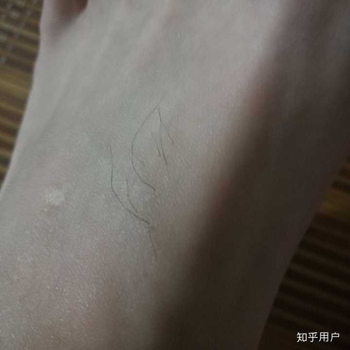 现在高三   初中还只是腿毛  后来发展为胸毛腹毛 最近发现   连我
