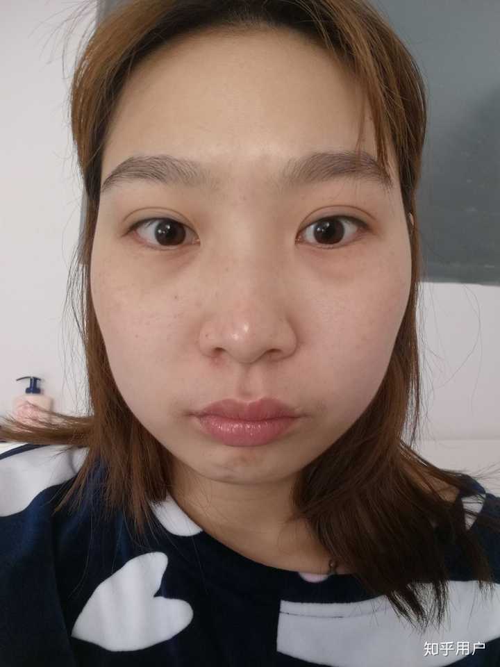 偏颌脸歪要怎么整?