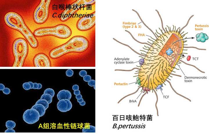 如果圣诞老人得了传染病会怎么样?