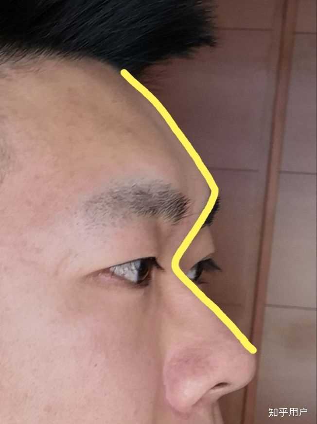 塌鼻子是一种什么样的体验?