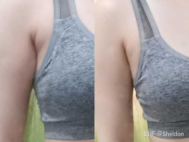 因为内衣没有穿好,两边腋下出现了副乳.我要怎么办～?