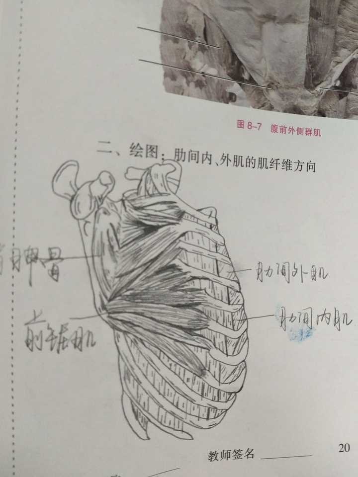 哪位有浅深屈肌腱,肋间内外肌的肌纤维方向,和左右肺纵隔面观的手绘图