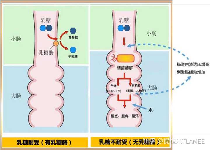 乳糖不耐受的原因是什么?